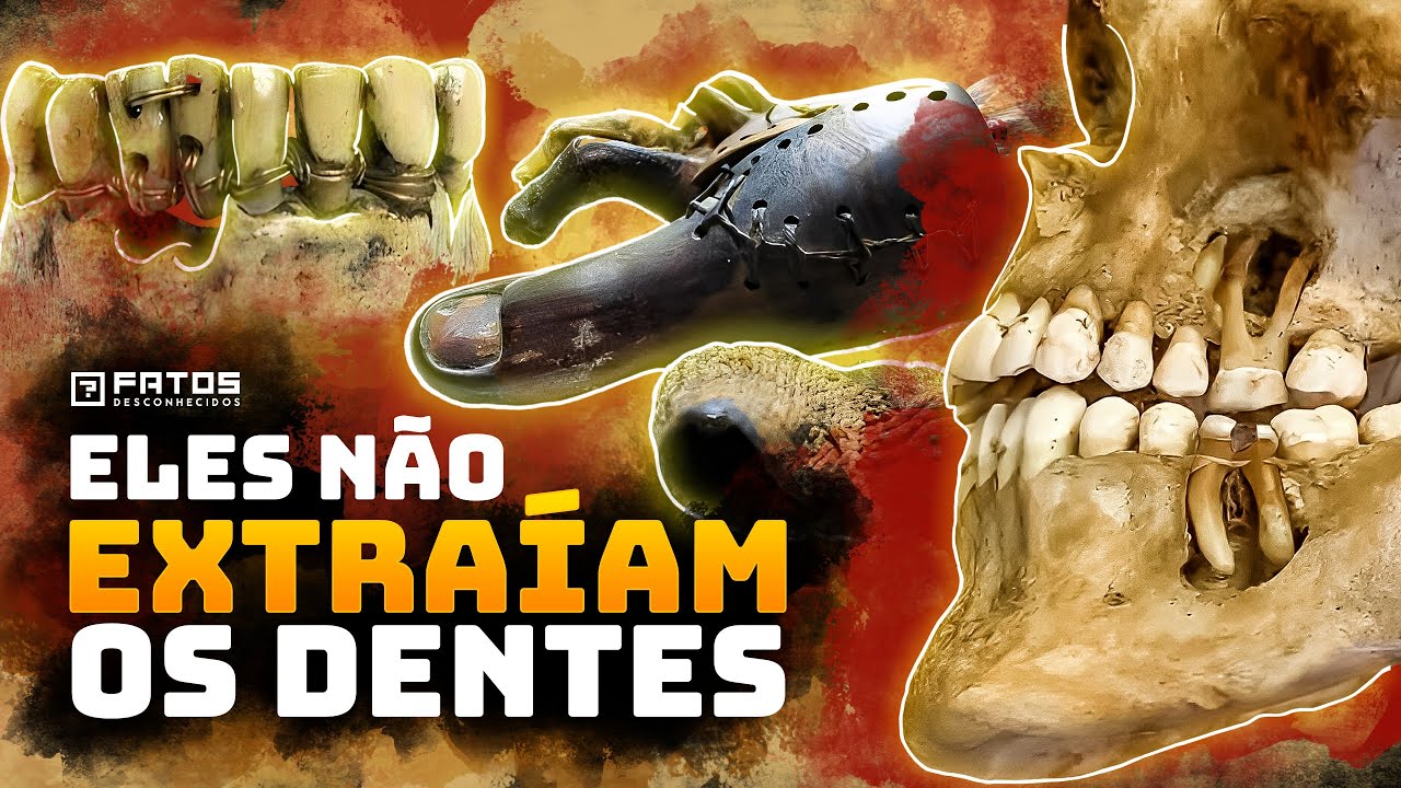 Fatos BIZARROS sobre as CIRURGIAS no ANTIGO EGITO