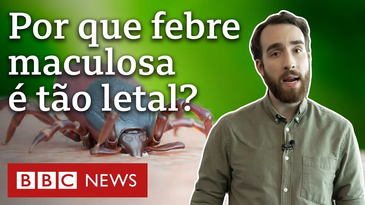 5 razões da alta letalidade da febre maculosa