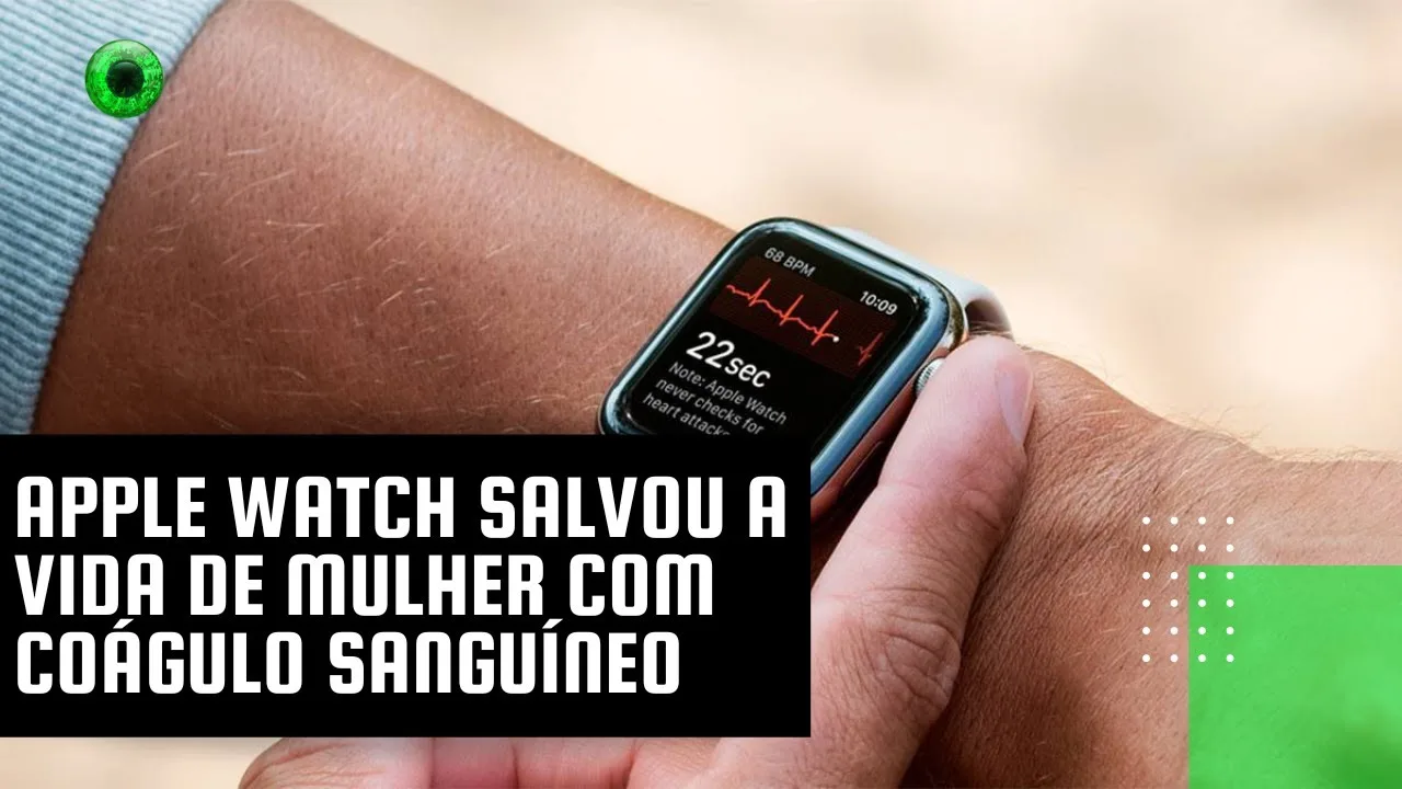 Apple Watch salvou a vida de mulher com coágulo sanguíneo