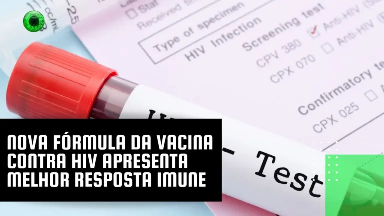 Nova fórmula da vacina contra HIV apresenta melhor resposta imune