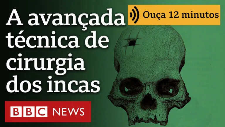 O crânio com perfuração retangular que confirmou que os incas realizavam cirurgias complexas