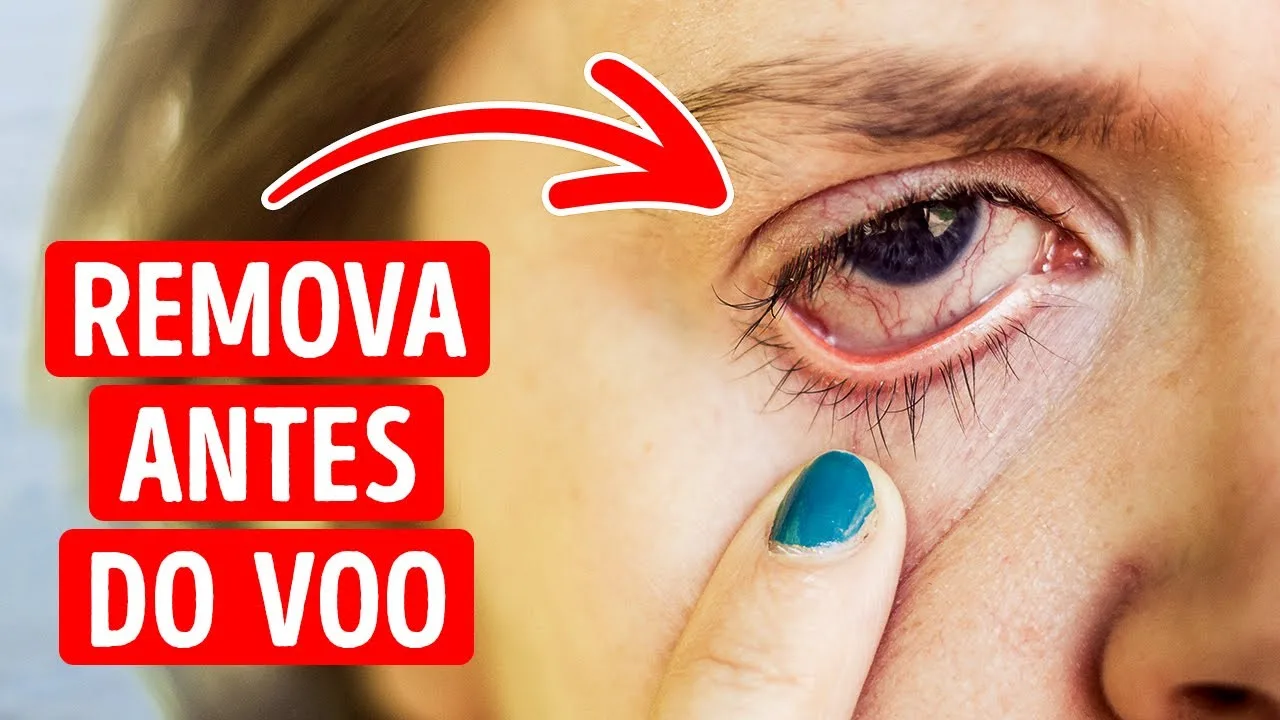 Por que Você Deve Tirar Suas Lentes Antes de Embarcar em um Avião?