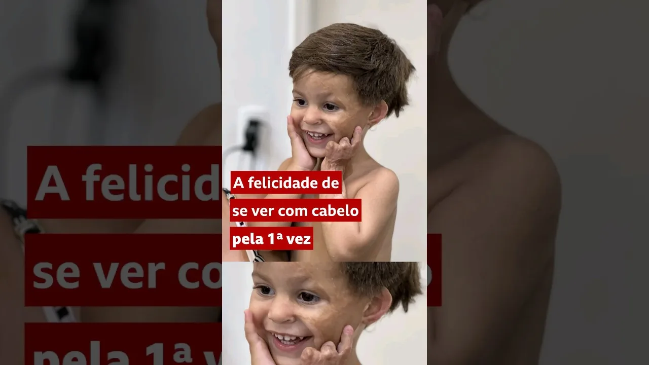 A reação de menino ao se ver com cabelo pela 1ª vez #shorts