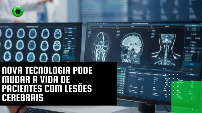 Nova tecnologia pode mudar a vida de pacientes com lesões cerebrais