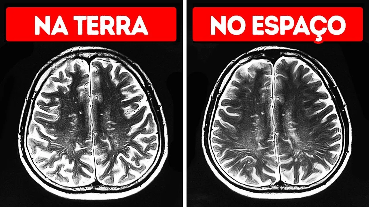 O Espaço Causa um Efeito Estranho no Cérebro e Outros 99 Fatos Legais Sobre o Corpo Humano