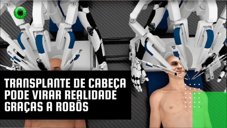 Transplante de cabeça pode virar realidade graças a robôs