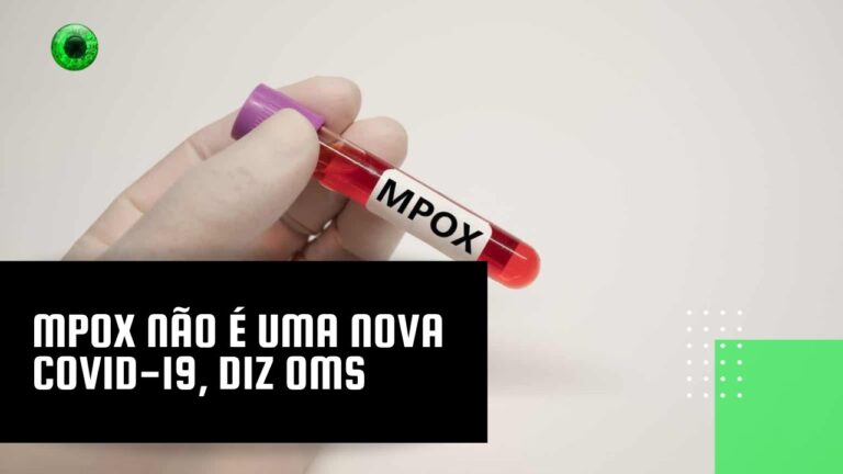 Mpox não é uma nova Covid-19, diz OMS