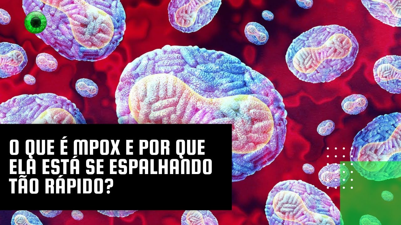 O que é Mpox e por que ela está se espalhando tão rápido?