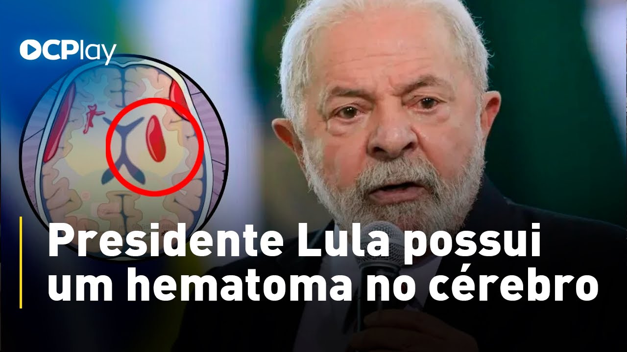 Lula cancela viagem após sofrer acidente doméstico