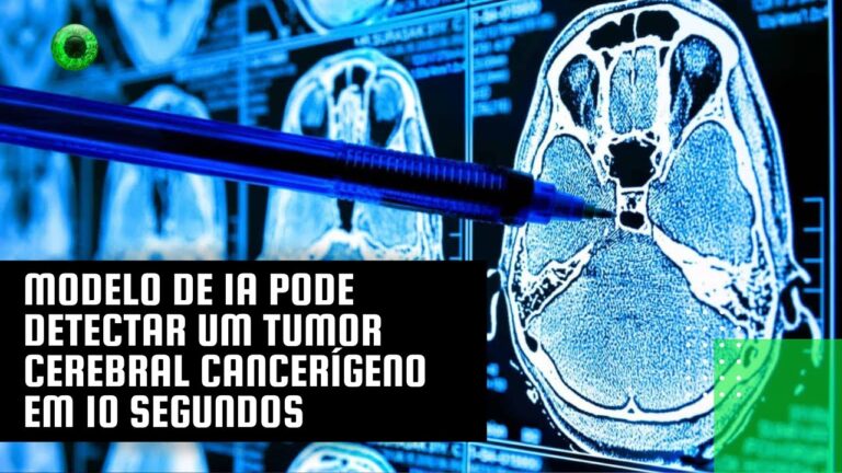 Modelo de IA pode detectar um tumor cerebral cancerígeno em 10 segundos