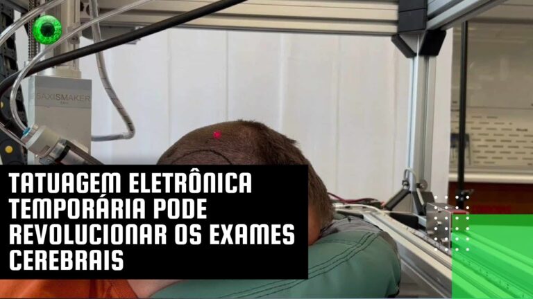 Tatuagem eletrônica temporária pode revolucionar os exames cerebrais