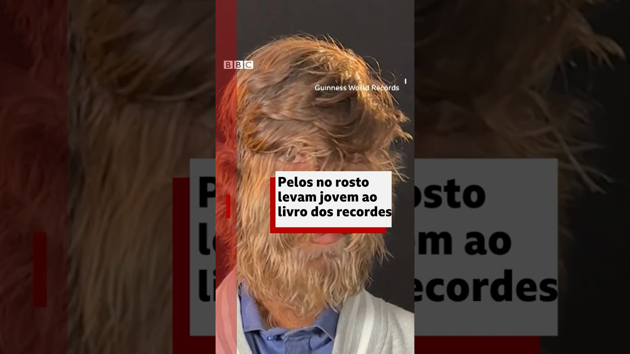 Guinness: adolescente entra no livro dos recordes por causa dos pelos faciais #bbcnewsbrasil