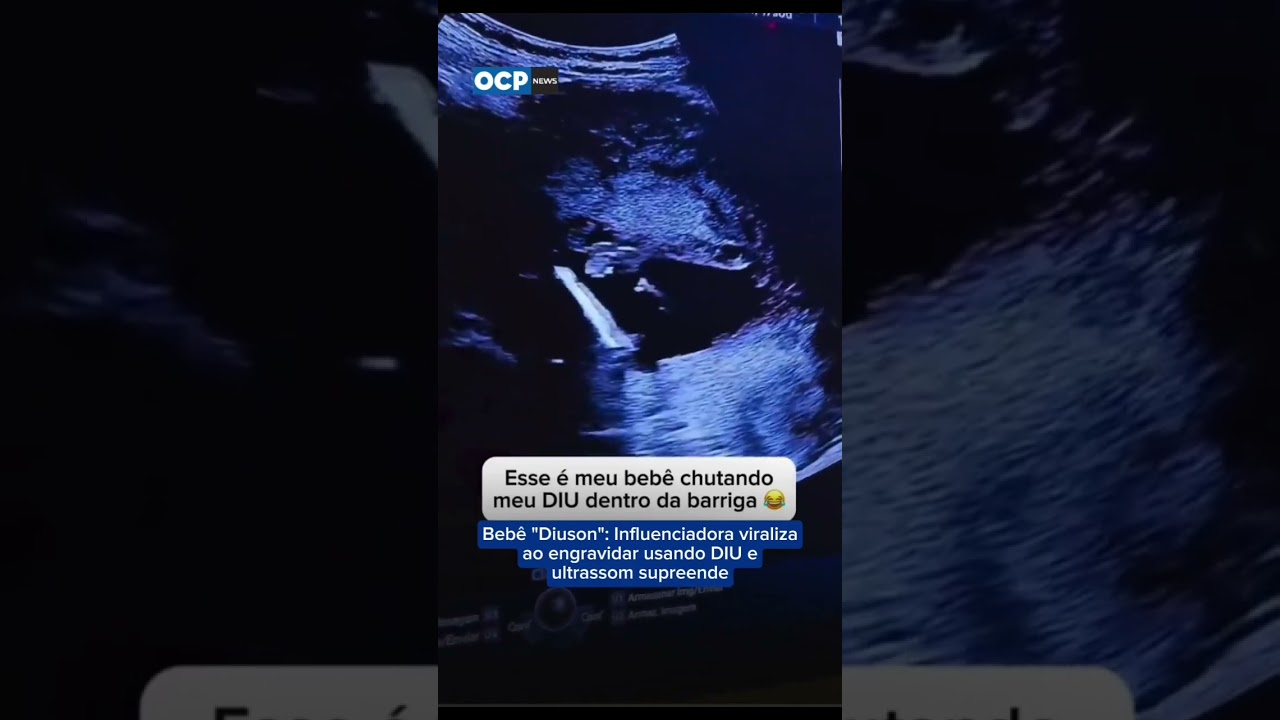 Influenciadora viraliza ao engravidar usando DIU e ultrassom supreende