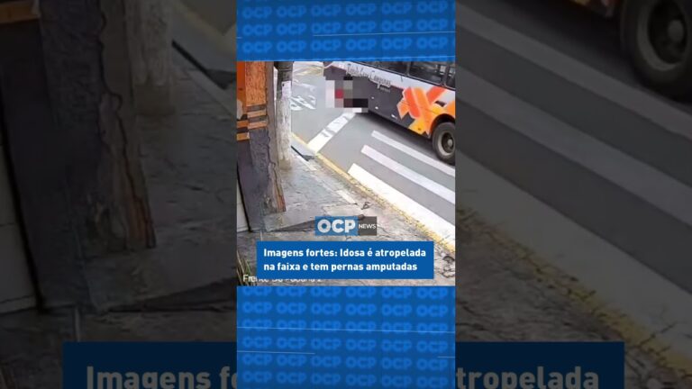 Idosa de 78 anos tem pernas amputadas após ser atropelada por ônibus em SP