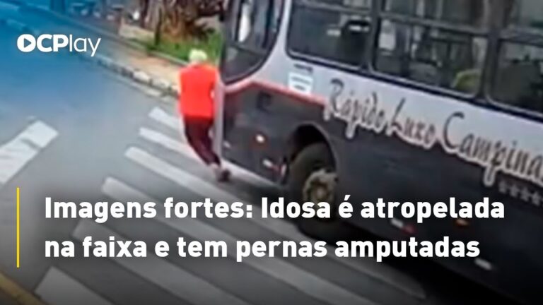 Idosa de 78 anos tem pernas amputadas após ser atropelada por ônibus em SP