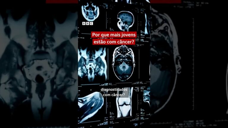 Por que cada vez mais jovens adultos estão tendo câncer? 🔬 #bbcnewsbrasil