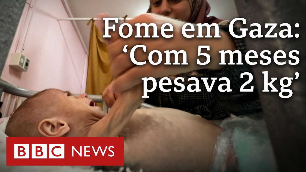 O drama da bebê desnutrida com bloqueio israelense em Gaza