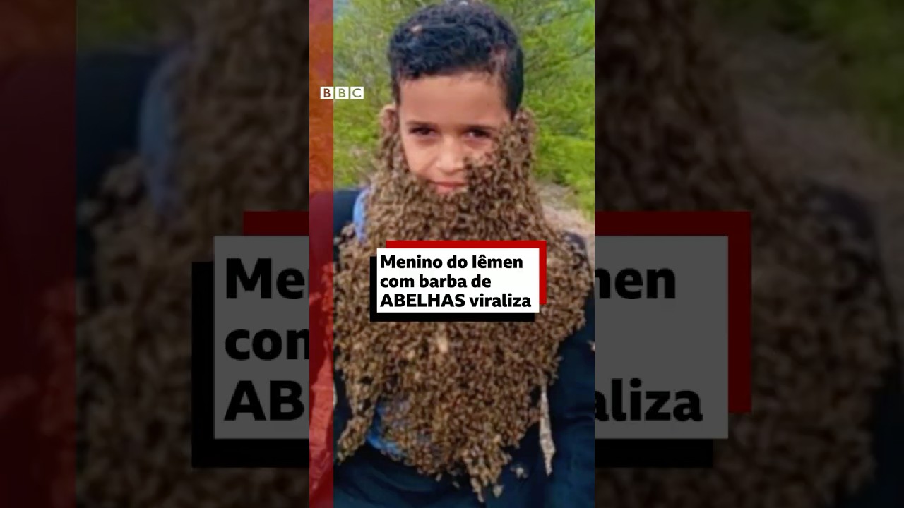 Menino do Iêmen viraliza com 'barba de abelhas'