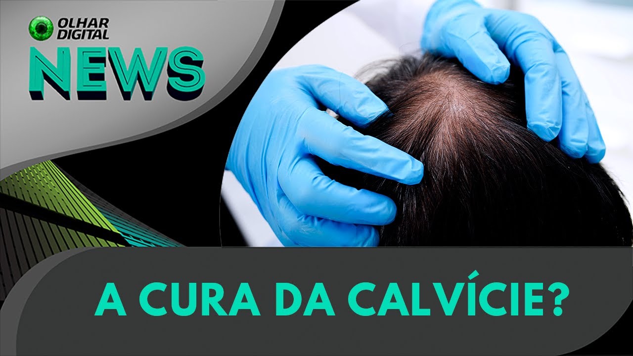 Ao vivo | Cura da calvície: agora vai? | 11/07/2025
