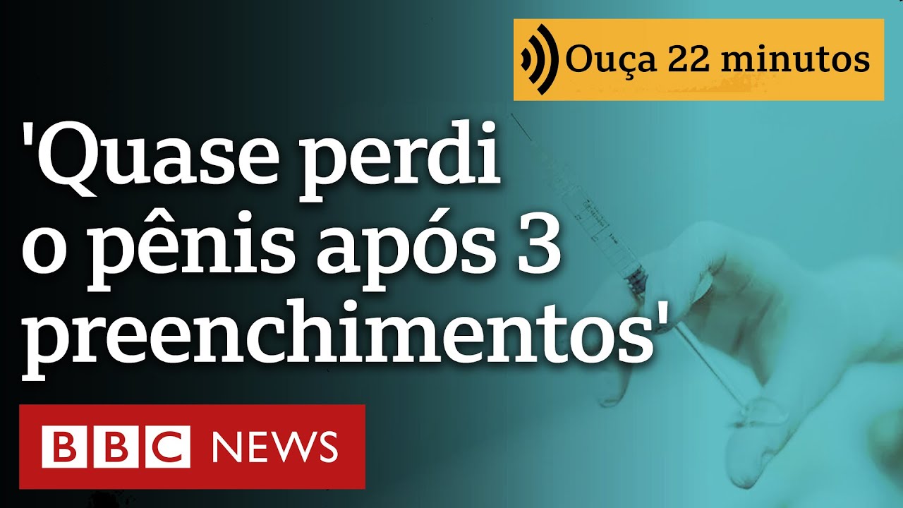 O que está por trás da febre da harmonização peniana no Brasil
