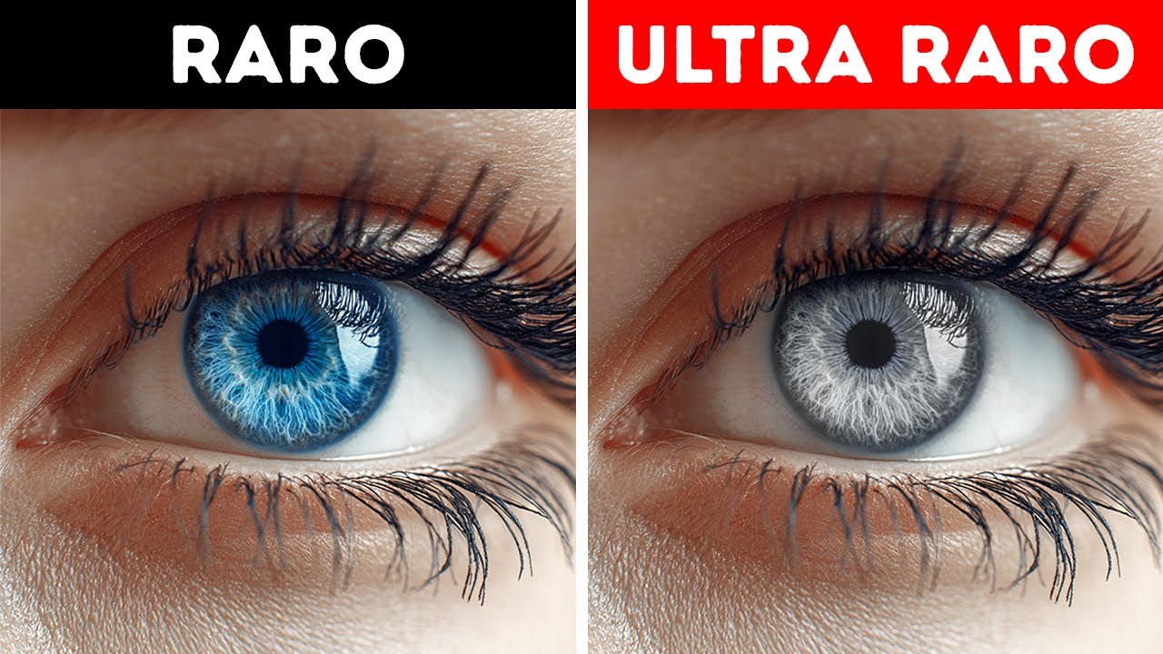 PODCAST: Por que você provavelmente nunca conheceu alguém com olhos cinzentos