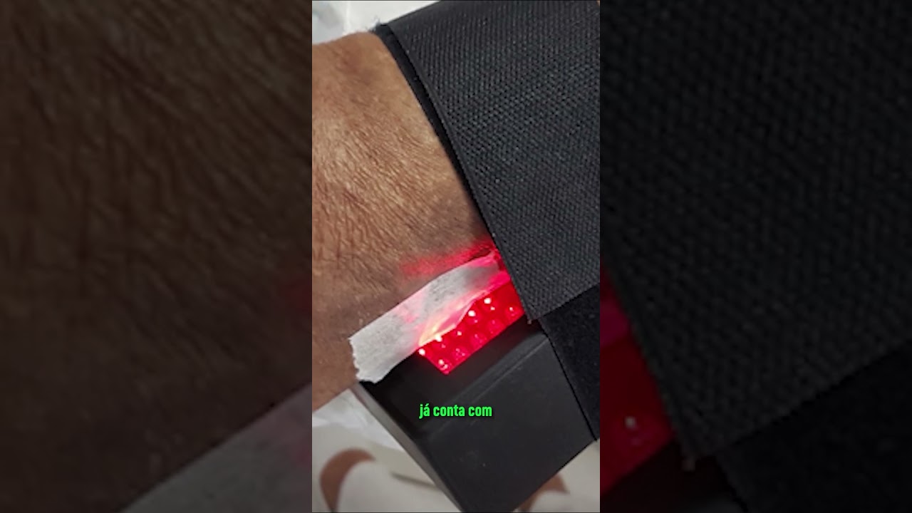 Diabetes: tecnologia brasileira pode reduzir amputações