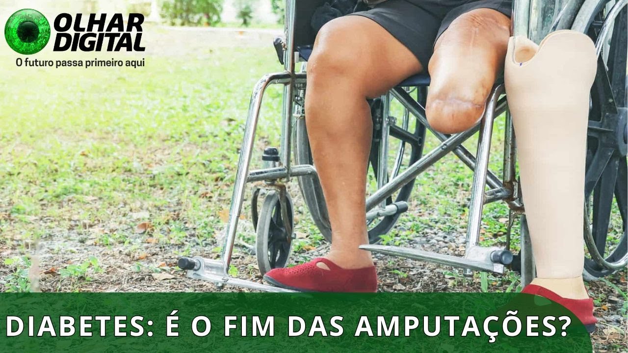 Diabetes: tecnologia brasileira pode reduzir amputações