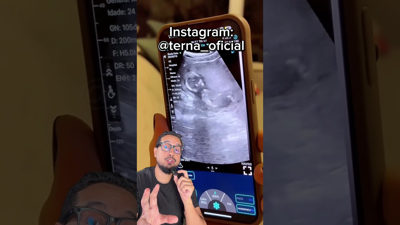 Mamãe agora podem fazer ultrassom em casa com esse dispositivo da Terna