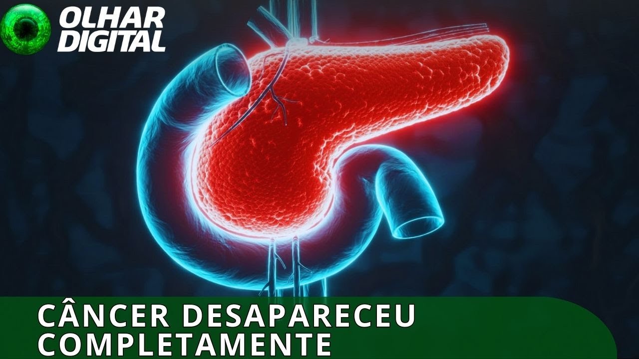 Combinação tripla elimina câncer de pâncreas em testes