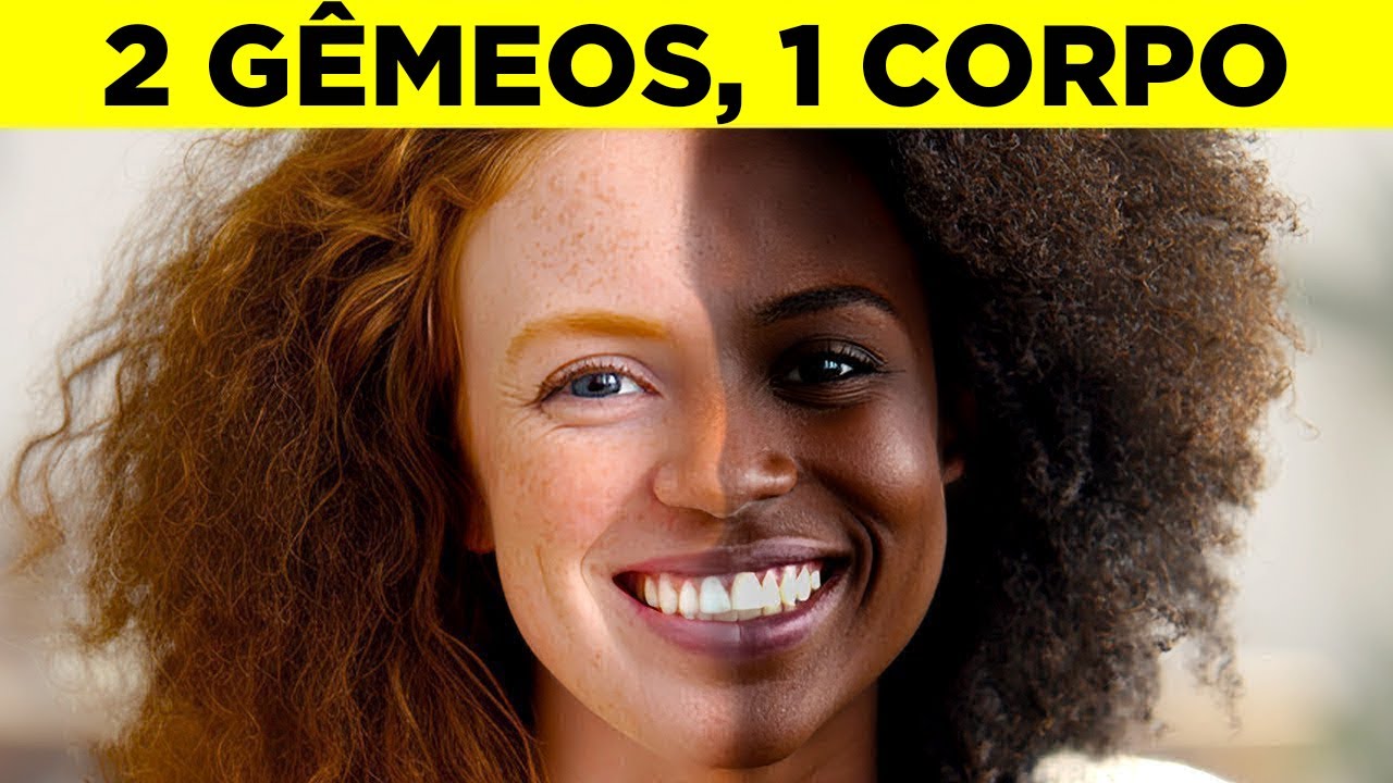 Gêmeos Que São 1 Em 1 Milhão