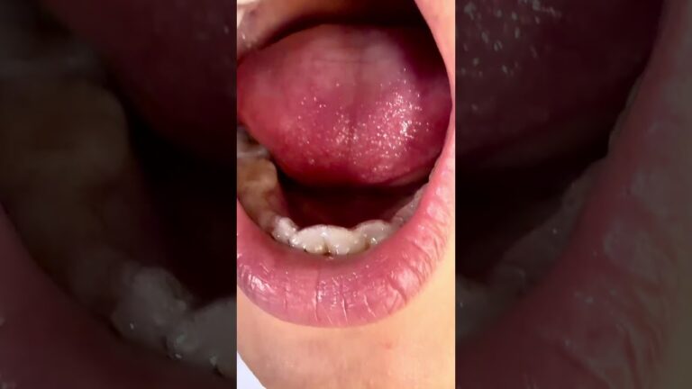 Esse tipo de aparelho acabou conheça o novo