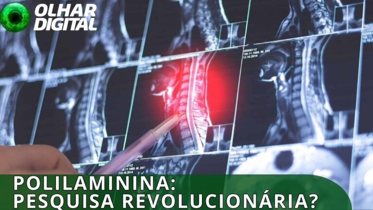 Por que cientistas pedem cautela no uso da polilaminina agora?