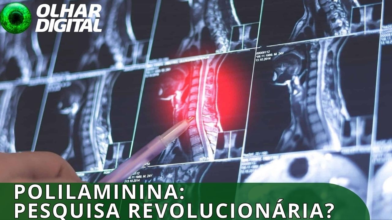 Por que cientistas pedem cautela no uso da polilaminina agora?