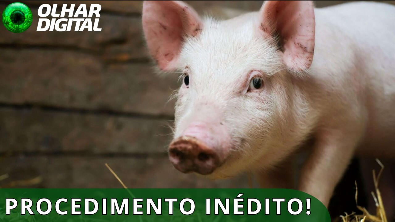 Fígado e rins de porco são transplantados simultaneamente em um humano