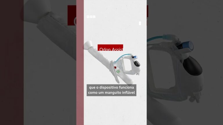 Argentino transforma truque com rolhas em dispositivo que ajuda no parto