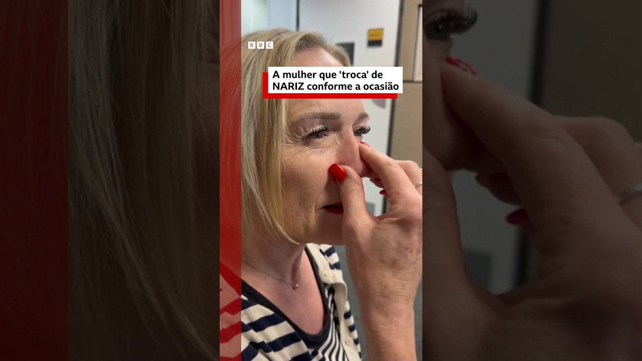 Mulher perde o nariz para uma doença rara e hoje usa próteses magnéticas para cada ocasião