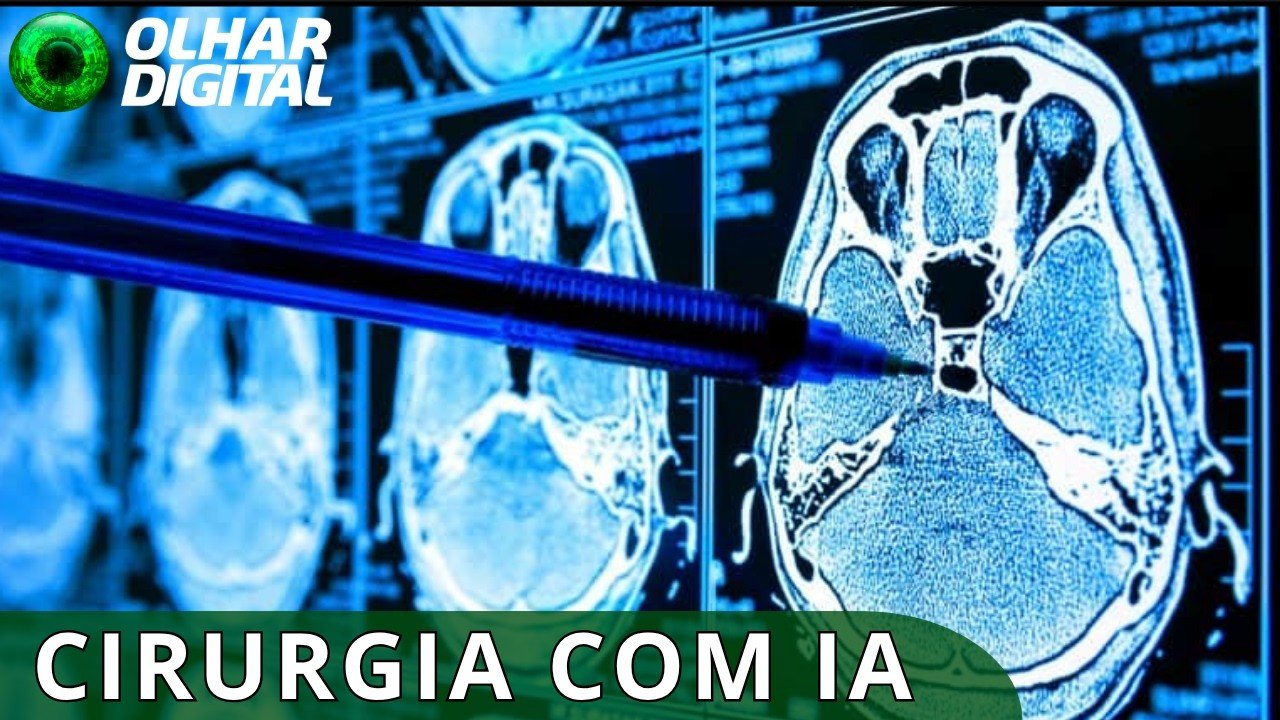 IA vira “segundo par de olhos” de médicos durante cirurgia cerebral inédita