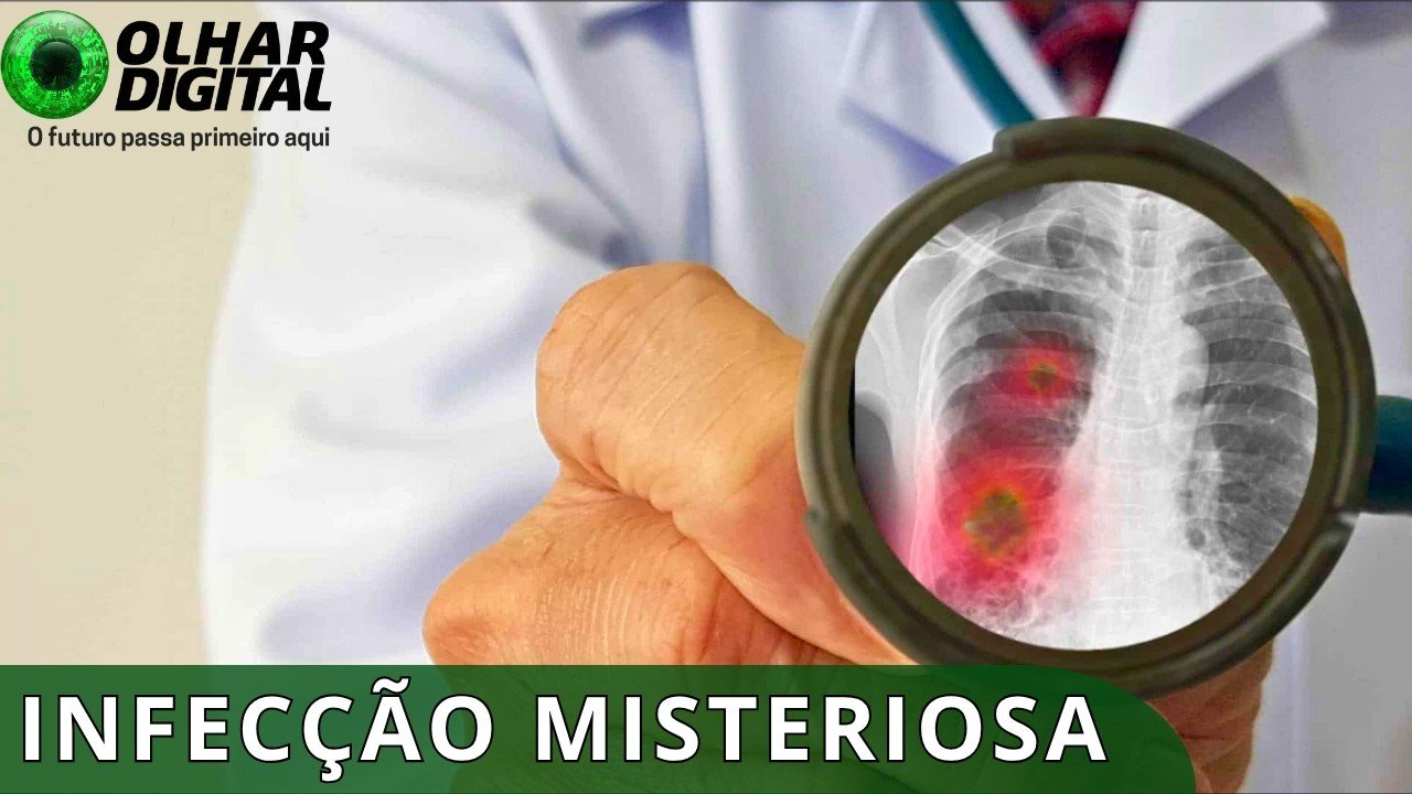 Rússia nega surto de peste pneumônica após morte em laboratório